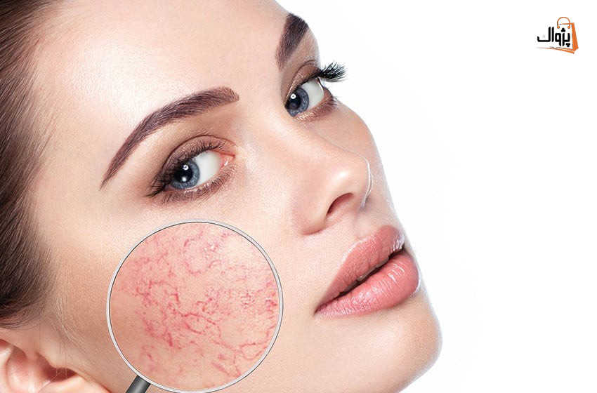 پچ تست  چطوری انجام میشه؟
